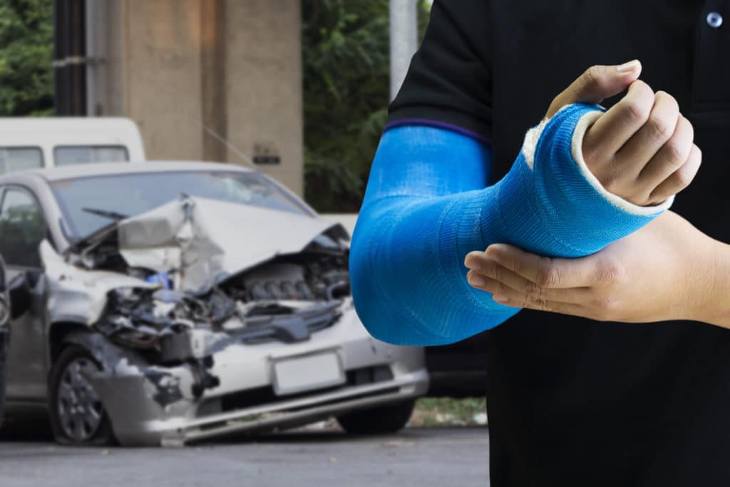 Person with broken bones in his arm holds a cast